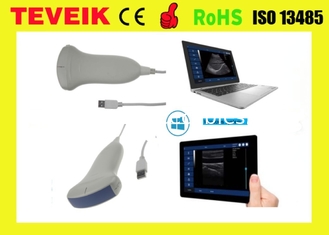 휴대용 의학 USB 볼록한 초음파 조사, 정제 컴퓨터를 위한 USB 노트북 초음파 변형기 일